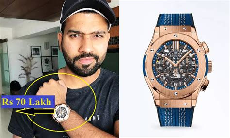 rohit sharma watch collection.